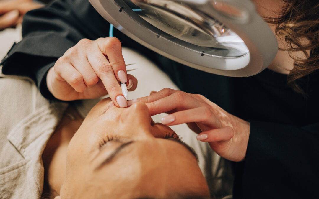 La Thermolyse : une solution définitive et bienveillante pour votre visage